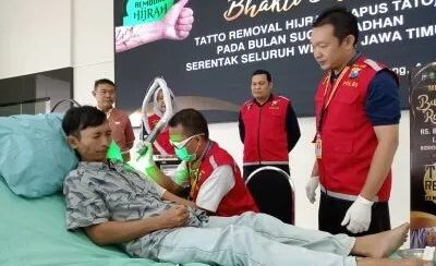 Polda Jatim Gelar Program Hapus Tato Gratis, Warga Antusias Mendaftar