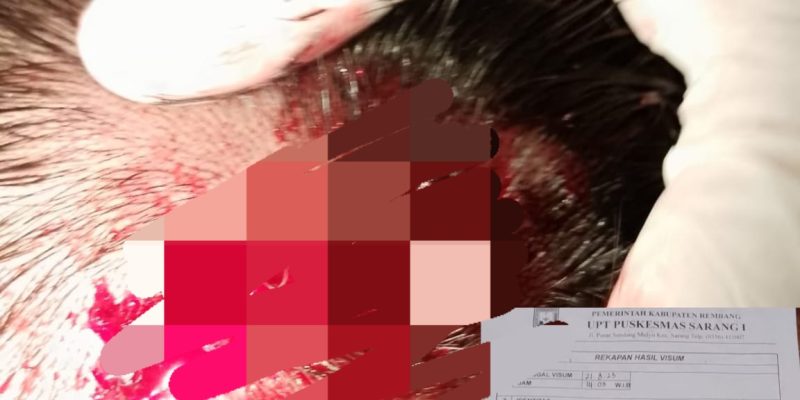 Pelimpahan Berkas Perkara Dugaan Penganiayaan Saudara Kusnanto Desa Dadapmulyo Kecamatan Sarang Ke Polres Rembang