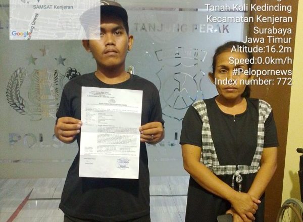 Dalih Bercanda, Irwan Bakar Kaki Teman Di Laporkan Polisi