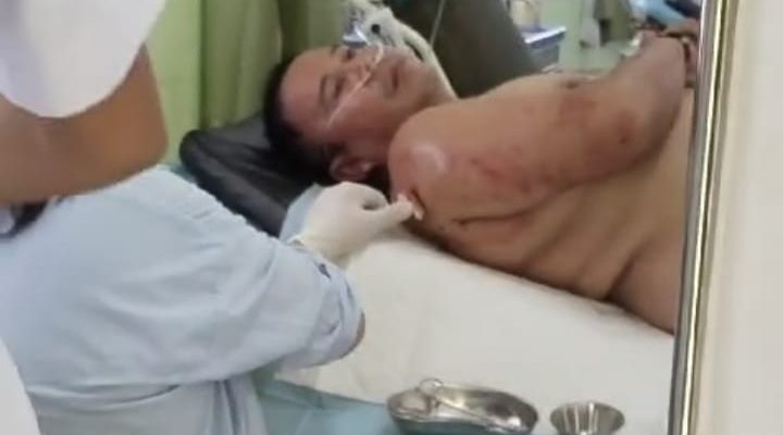 Polsek Manuhing Terus Lakukan Pencarian Pelaku Penembakan di Pos Pam  PT. BMB