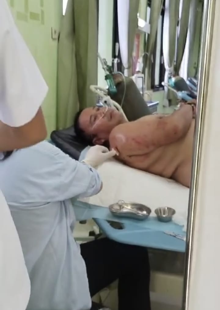 Polsek Manuhing Terus Lakukan Pencarian Pelaku Penembakan di Pos Pam  PT. BMB