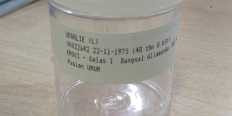 Asisten Humas PT. BMB Jadi Korban Penembakan Dan  Meninggal Dunia