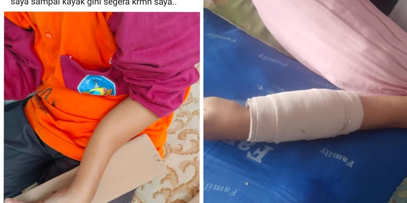 Siswa SMPN di Lumajang Diduga Jadi Korban Bullying