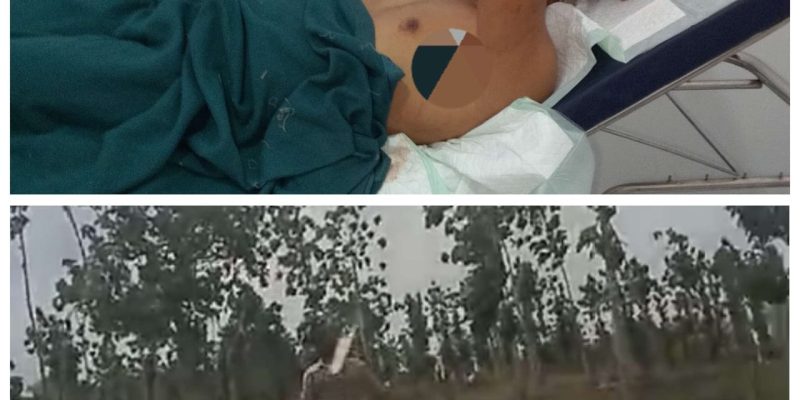 Polda Jatim Harus Ambil Alih Dan Segera Tangkap Pelaku Dalang Pembacokan Wartawan di Wilayah Polres Tuban