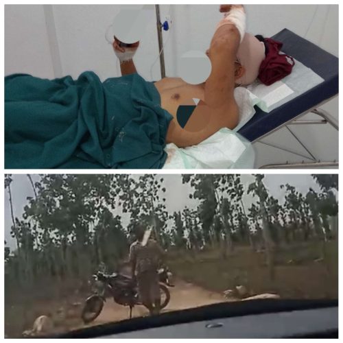 Polda Jatim Harus Ambil Alih Dan Segera Tangkap Pelaku Dalang Pembacokan Wartawan di Wilayah Polres Tuban